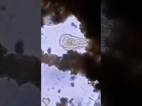 Is Stentor a parasite?