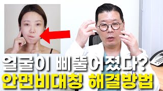 [JP]턱이랑 코가 삐뚫어져 있어요ㅜㅜ 안면비대칭 때문에 고통스러우시죠?