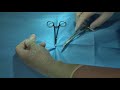 basic surgical technique