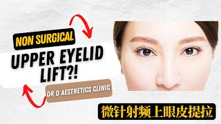 RF micro-insulated needling 无刀无痕 | 微针射频 | 创上眼皮提拉｜Dr D Aesthetics Clinic