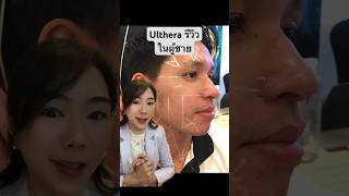 Program Ulthera รีวิว ในผู้ชาย ทำได้มั้ย ❓ #ultheraรีวิว #ยกกระชับ #ultherapy #ulthera #ultheraspt