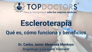 ¿Sabías que la escleroterapia es la mejor opción para las várices?