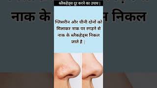 ब्लैकहेड्स हटाने के घरेलू उपाय :😱 Home Remedies for Blackheads Removal #shorts #viral #blackheads