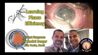 CataractCoach.com guest surgeon teaches us Cataract Surgery Efficiency