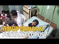 Berjuang hidup normal dengan penyakit lupus | JELANG SIANG