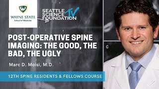 Post Operative Spine Imaging : The Good, the Bad, the Ugly- Marc D. Moisi, M.D.