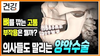 웬만하면 의사들도 말리는 양악수술의 위험성 | 어떤 사람들이 양악수술을 해야할까? | 양악수술 부작용 | 턱의 구조 | 명의