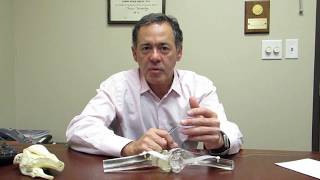 Total Knee Replacement VS Partial Knee Replacement - Dr. Frank Garcia