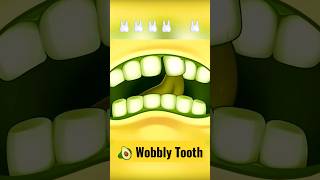 Wobbly Tooth #avocadocouple #wobblytooth #shorts