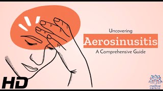 Aerosinusitis: Sinus Pain in the Skies