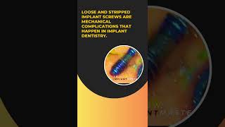 Loose and stripped implant screws are mechanical complications that happen in implant dentistry.