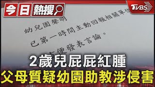 2歲兒屁屁紅腫 父母質疑幼園助教涉侵害｜TVBS新聞 @TVBSNEWS01