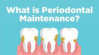 Periodontal Maintenance - What is it?