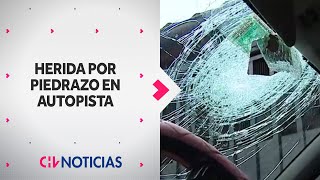 Conductora recibió piedrazo en rostro mientras manejaba en autopista: “Podría haber muerto”