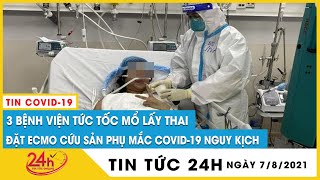 Cận Cảnh Bác sĩ 3 bệnh viện ở TP HCM mổ bắt con cho nữ bác sĩ mắc COVID 19 nguy kịch  Tin mới TV24h