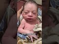 ৩৪ সপ্তাহের বেবি দেখতে কেমন হয় দেখুন newbornbaby drataurrahman cute premature