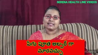 పేగు పూత అల్సర్ గా మారవచ్చు| ulcer disease | causes |symptoms | diagnosis | treatment and diet