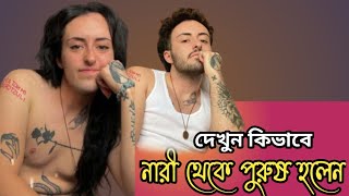 নারী থেকে পুরুষ | নারী থেকে পুরুষ হলেন যেভাবে | প্লাস্টিক সার্জারি করে নারি থেকে পুরুষ হলেন