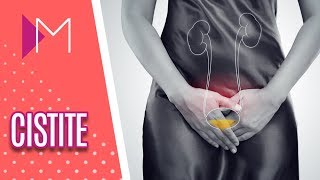 Cistite: descubra as causas e tratamentos dessa infecção urinária - Mulheres (11/09/18)