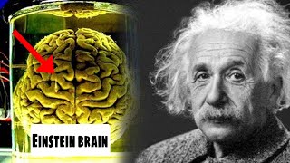 आइंस्टीन का दिमाग कैसे अलग था? How Einstein's Brain Was Different? #shorts #einstein