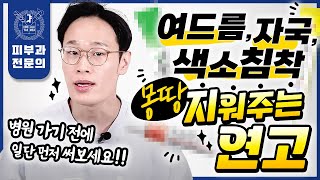 일단 믿고 발라보세요 피부과전문의도 바르는 여드름, 여드름자국, 여드름흔적, 여드름흉터 연고 총정리! | 여드름연고 흉터연고 약국템추천