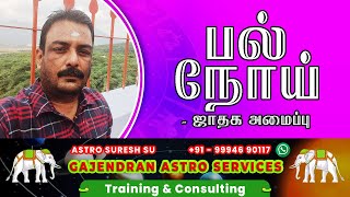 பல் நோய் – ஜாதக அமைப்பு | Dental Disease | Astrology