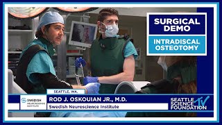 Intradiscal Osteotomy - Rod J. Oskouian, Jr. M.D.