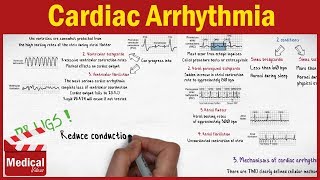 Pharmacology - Cardiac Arrhythmia and Antiarrhythmic Drugs FROM A TO Z