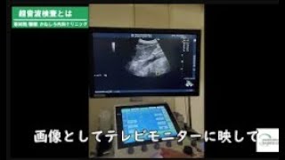 超音波（エコー）検査とは