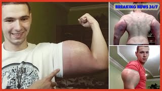 Russian wannabe bodybuilder injecting himself with oil - Breaking News 24/7