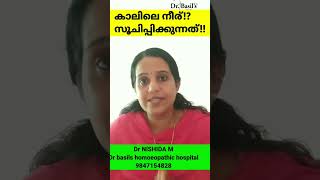 കാലിൽ നീര് സൂചിപ്പിക്കുന്നത്!!#doctor #shorts#ആരോഗ്യം #healthtips