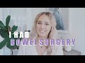 I had bowel surgery - ILEOCOLECTOMY: CROHN’S DISEASE - Sally Boebally