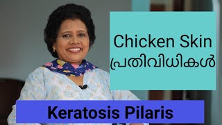 Chicken Skin Remedies | Dr Lizy K Vaidian