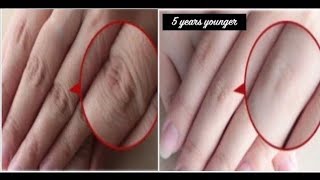 How to Make Your Hands Look 5 Years Younger Overnight! Wrinkle-free smooth fair hands