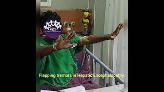 FLAPPING TREMORS IN HEPATIC ENCEPHALOPATHY