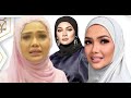 Pernah Digelar “Zarina Kutu” Hanya Kerana Hidup Susah & Rambut Penuh Kutu