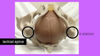 Topic 11: Intrapartum Care *