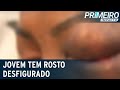 Jovem tem rosto desfigurado após ser agredida por namorado | Primeiro Impacto (13/07/21)