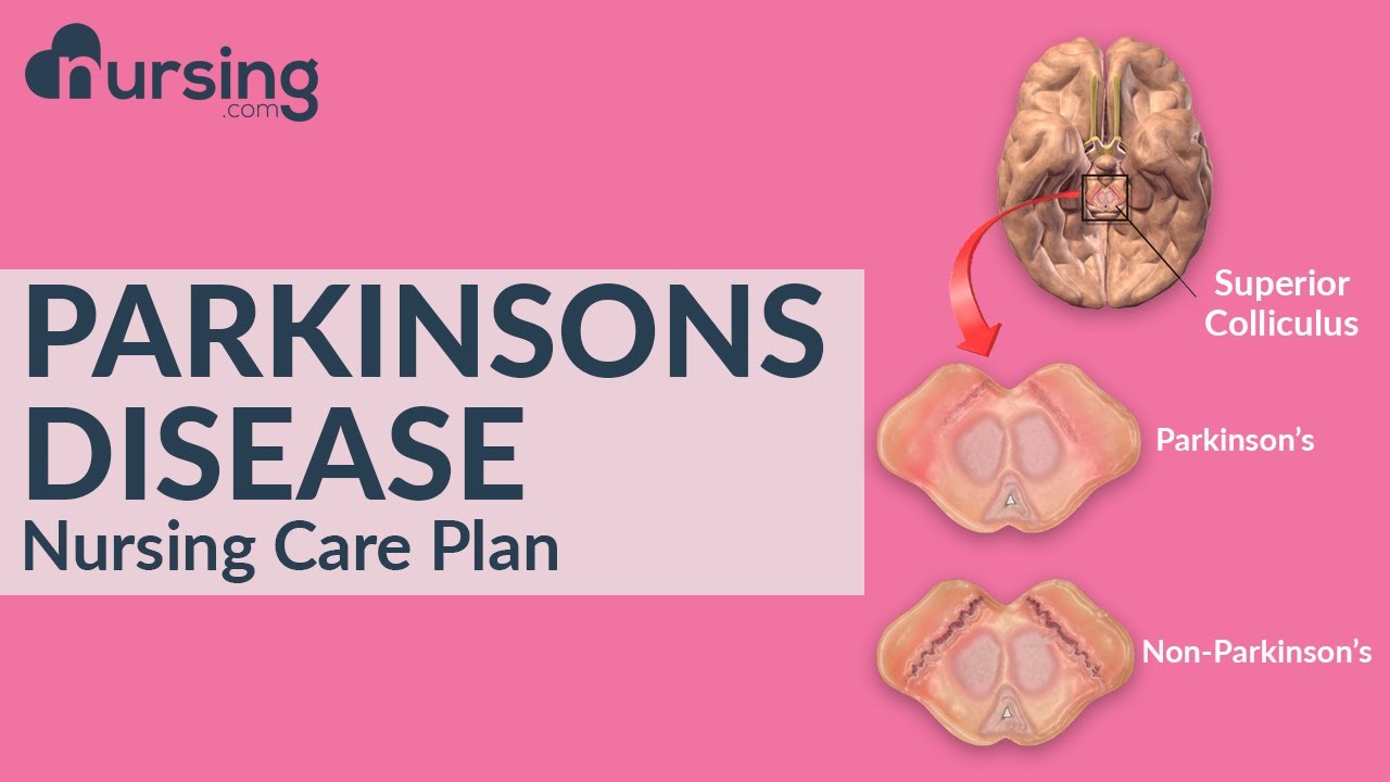 Nursing Care Plan For Parkinson's Disease (Nursing Care Plan Tutorial ...