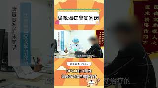 男性尖锐湿疣康复案例——HPV11和51阳性做过两次激光都复发了