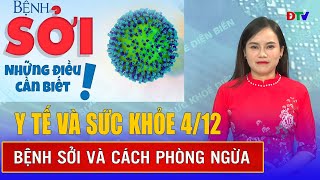 Bệnh sởi và cách phòng ngừa | Y tế và sức khỏe 4/12 | Điện Biên TV