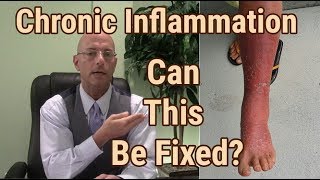 Chronic Inflammatory Response: Removing The Causes Of Chronic Disease