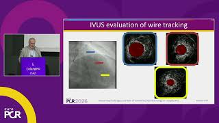 Remaining challenges and role of innovative DES technology in complex PCI - EuroPCR 2026