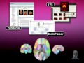 loni probabilistic brain atlas