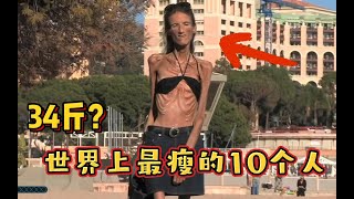 才34斤？？世界上最瘦的10个人