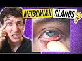 Best Treatment for Meibomian Gland Dysfunction? #shorts
