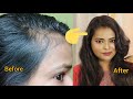 अब घर में बनाए Faster Hair Regrowth  Oil | Homemade Fast Hair Regrowth Oil Recipe|Shinny Roops