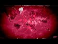 adverse reactions plague inc ost