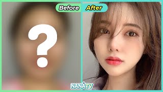[SUB] Best 5 plastic surgery transformation | Korean beauty transformation | Tra