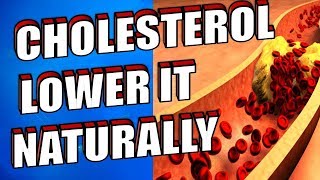 21 Ways To LOWER CHOLESTEROL Naturally | Lower Cholesterol Fast & Quickly
